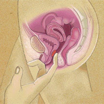Comment trouver le point g d une femme pdf